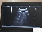 Czech Hunter - Tiny Twink Barebacked On Ultrasound At...